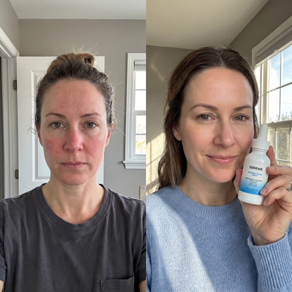 Complete Restore & Relief Serum
