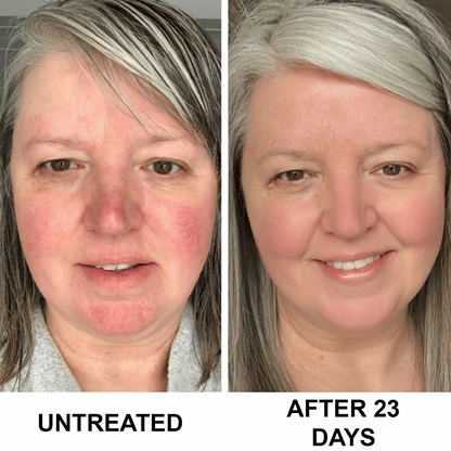 Complete Restore & Relief Serum