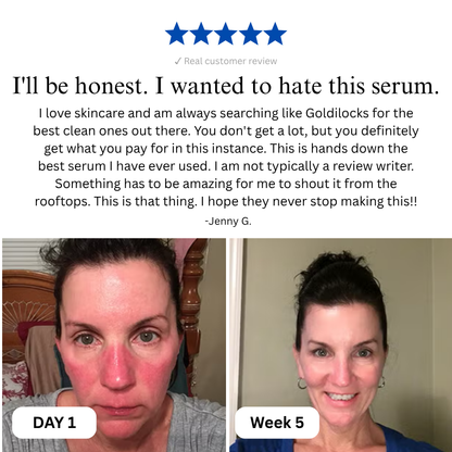 Complete Restore & Relief Serum