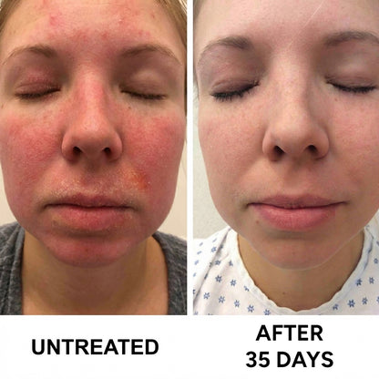 Complete Restore & Relief Serum