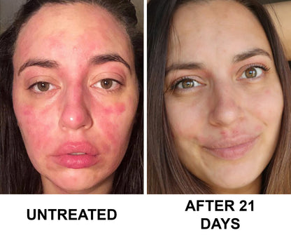 Complete Restore & Relief Serum