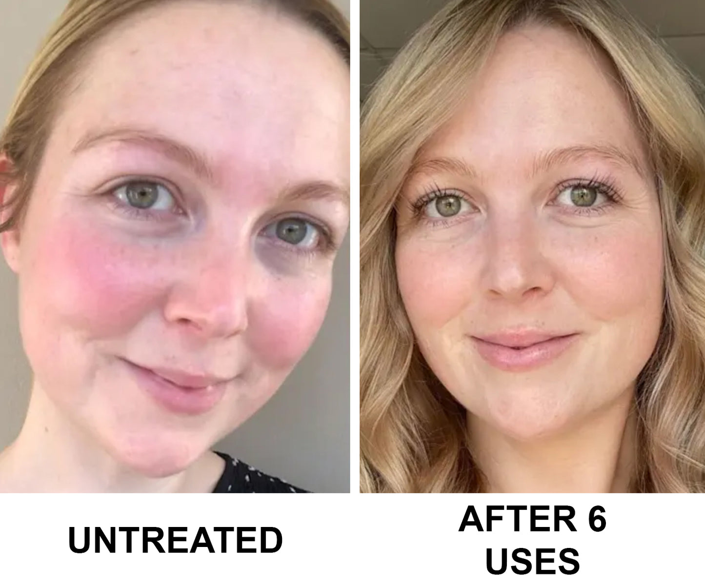 Complete Restore & Relief Serum